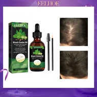 Eelhoe Castor Oil Hair Care Solution For Preventing Hair Loss, Firming And Firming Hair, Scalp Massage And Nutritional Care Organic Castor Oil For Hair Growth Jamaican Black Castor Oil Nourish Eyelashes And Eyebrows Scalp, Skin And Nails Care