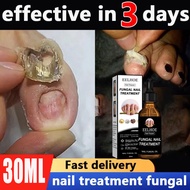 Tinh chất sửa chữa móng tay nấm móng Chống nấm móng 30 ml chống nhiễm trùng tinh chất chăm sóc huyết