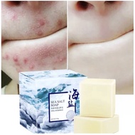 Goat Milk &amp; Sea Salt Whitening Herbal Soap - Pimple &amp; Acne Treatment, Pore Reduction &amp; Oil-Control - Collagen-Boosting F