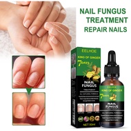 EELHOE Nail Repair Solution 50ml Moisturizing Nail Thickening Gray Nails Repair Onychomycosis Serum 