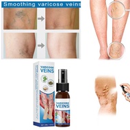 Penghilang Varises Vaskulitis Varises spray sakit bagian kaki Cream spray varises 30ML