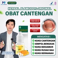 Propolis SM Herbal Ingrown Toenail Treatment – Treats Nail Infections, Swelling, and Purulent Wounds