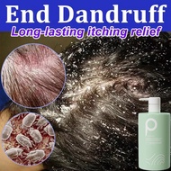 shampoo kelemumur ubat kelemumur kepala syampoo Psoriasis Shampoo dandruff treatment kulit kepala ke