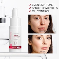 LAIKOU Pro 10% Niacinamide Serum & Esen Wajah Memutihkan Bintik Gelap Mengurangkan Kedutan Mencerahk