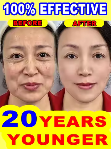 20 years younger 20 years younger, 100% wrinkles disappear