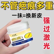 Scar Special No Trace Old Scar Scar Removal Bump Surgery C-Section Scar Fading Scar Pit Pigment Scar