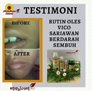OBAT SARIAWAN AMPUH BPOM OBAT SARIAWAN MULUT DEWASA OBAT SARIAWAN ANAK OBAT SARIAWAN UNTUK BAYI OBAT