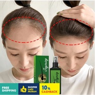 Jaysuing Ginger Hair Growth Spray Rambut Gugur Hair Tonic Growth Natural Anti Hair Loss Fast Hair Gr