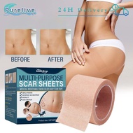 Silicone Scar Sheet Scar Patch Concealer Tattoo Cover