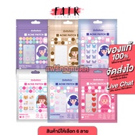 DODODOTS Acne Patch [6 Designs To Choose From] Hydrocolloid Absorbent Sheet Hydrocolloid Patch