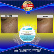 CLARO freckle remover cream  freckle remover cream  freckle removal whitening cream  freckles remova