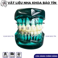 Orthodontic consultation jaw model, braces consultation jaw model, braces consultation jaw model