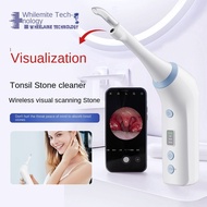 Visualized Electric Tonsil Calculus Device Oral Cleaning Nursing Tool Calculus Remover Wireless Visi