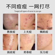 2025readystock Acne Removal Cream Repair Acne Marks Acne Pit Acne Removal Acne Cream Acne Removal Cr