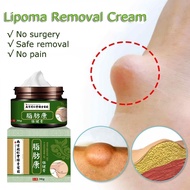 Lipoma removal cream-Lipoma removal cream original-Lipoma cream- Lipolysis Fat Lump External Swellin