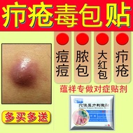 蕴祥 火疖子非拔毒膏疖子 拔脓贴疖疮贴 毛囊发炎脓包 拔毒贴 硬块 坐板疮穴位压力刺激贴