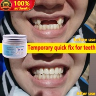 【Fast filling】DIY Tooth Repair Kit Temporary Teeth Restoration 50g Artificial temporary tooth teeth Teeth And Gaps FalseTeeth Solid Glue Denture Adhesive Glue Decorative Denture Tooth Repair Glue Moldable False Teeth