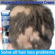Baldness Cream Alopecia Hair Growth Cream20g Alopecia Fast Hair Growth Oil Anti Alopecia Fast Hair G