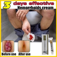 【3 days effective】Hemorrhoids Ointment Cream Hemorrhoids Miracle Ointment Shrink Swollen Hemorrhoid Tissue Reduce Heat and Inflammation Relieve Hemorrhoid Pain Clear Away Toxic Materials Remove Decayed Tissues External Hemorrhoids Anal Fissure