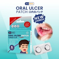 ACUMEDI Tampalan ulcer mulut lulus MDA Oral Ulcer patch with MDA Approval