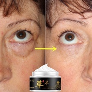 dark circle remover Eye cream for dark circle Eyebag remover for anti aging Herbal Essence Eye Cream