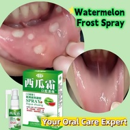 Ubat Sembur Ulser Mulut HFMD Ulser Mulut For Canker Sores Oral Sariawan Relieve Gum Ulcer Pain AntiB