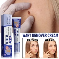 SOUTH MOOM inhibit wart growth cream 20g