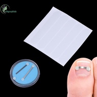 STHB Ingrown Toenail Recover Pedicure Tool Toe Braces Toenail Straightener Toenail Fixer Bunion Corr