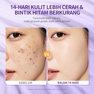 IROHADA 377 Dark Spot Remover Cream Brightening Whitening Fade Cream for Melasma Hyperpigmentation