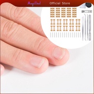 [MagiDeal] Ingrown Toenail Correction Patch, Breathable Toenail Correction Stickers, Pedicure Tools
