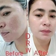 Terjamin Paket Flek Cream Malam Ncf Drw Skincare original REDAY STOK