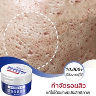 วิตามิน E ครีมทาหน้า 100g กำจัดรอยสิว ลดหลุมสิว ให้ความชุ่มชื้น &amp; ไวท์เทนนิ่ง Acne scar cream เหมาะสำหรับผู้มีปัญหารอยสิว รอยดำ