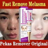 Whitening Freckle Cream Niacinamide Melasma Remover Cream Pekas Remover Lighten Dark Spots