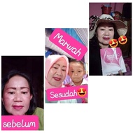 Marwah diamond acne / marwah acne / marwah skincare / marwah skin care / original marwah cream / mar