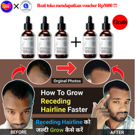 Serum penumbuh rambut 60ml Hair tonic ginseng Hair care Penumbuh rambut botak wanita dan pria Penumb