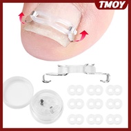 TMOY 1/2 Set Ingrown Toenail Corrector Tools Pedicure Recover Embed Toenail Treatment Foot Care Corr