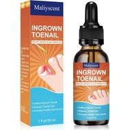 Ingrown Toenail Drop - Ingrown Toenail Pain Reliever and Softener Kit for Men Women Ingrown Toenail 