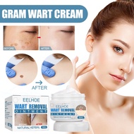 Natural Gentle Wart Remover Cream 50g Painless Warts Remover Cream Mole&Skin Tag Remover  Corn Plast