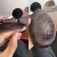 Men Forehead Hairline Bio-Mask Hair Sheet Bio-Fiber Curly Hair Invisible Invisible Increase Hair 2.1