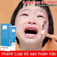 Fast scar removal cream, abrasion scars, burns, post-operative wounds, quick scar removal 20g