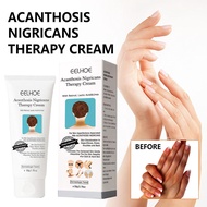 50ml Whitening Cream Acanthosis Nigricans Therapy Cream E3G8