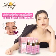 SoeAura Gold  Bightening perfect Serum တင်းတိပ်အမဲစက်ပျောက်/ချွေးပေါက်ကျဥ်းစေတယ်2ပတ်အတွင်းဖြူဝင်းစေတ