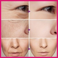 The Ordinary Granactive Retinoid in 2% Emulsion (30ml)