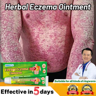 gamot sa kati kati sa balat ointments for skin deases eczema treatment cream bioderm ointment psoria