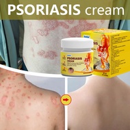 Psoriasis Cream Antifungal cream Eczema cream Cream gatal kulit 20g krim gatal kulit herba cina Ubat