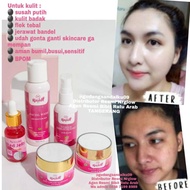 BY07 PAKET SKINCARE PEMUTIH WAJAH CREAM BPOM NR GLOW RJN SKINCARE