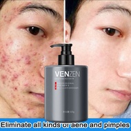 jerawat pencuci muka lelaki sabun cuci muka lelaki amino acid face wash men's facial acne cleanser O