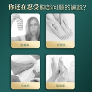 Agent Cream Itch Spray 4.13 Athlete's Foot Athlete's Foot Cleansing Powder Spray Anti-Itch Cream Ton