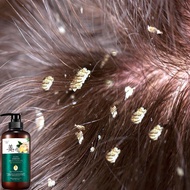 shampoo kelemumur anti dandruff shampoo dandruff treatment ubat kulit kepala berkuping Oil Control h