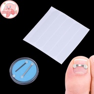 ruelen Ingrown Toenail Recover Pedicure Tool Toe  Toenail Straightener Toenail Fixer Bunion Correcto
